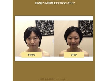 アジール 長岡リバーサイド千秋店(agir)/Before/After画像