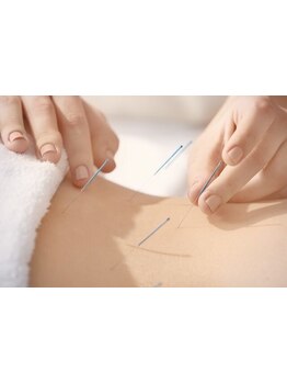 鍼灸施術を受けたい