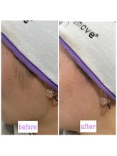 ベリンダ ワックス(BELINDA WAX)/もみあげお任せ下さい