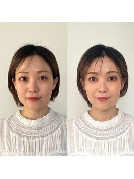 パーソナルサンフラワー(PersonalSunflower)/お客様ヘアメイク Before/After