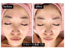 マリア(MALIA)の雰囲気（お肌を育てるマイルドピーリング!やればやるほど若見え肌へ！）