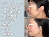【西日本初取扱店】LDMリフティング+光フォト<小顔/シミケア/くすみ/リンパ>