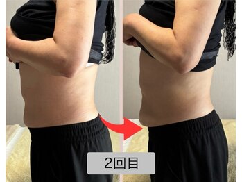 リセル(Recell)/お腹★脂肪分解