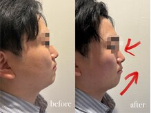 エネ ラッシュアンドブロウ バイ アンドエラ(ENNE Lash&Blow by&ERA)/小顔整体