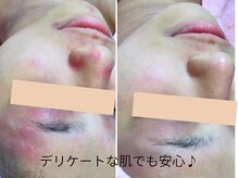 エステティックサロン アールグレー/フェイシャルメニュー10種類以上