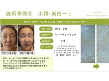 エルエー(LA)の雰囲気（小顔艶肌スペシャルコース120分）