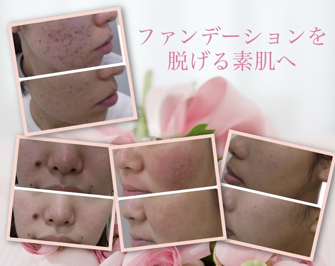 フェイシャルスタイリストサロン 四谷店｜ホットペッパービューティー