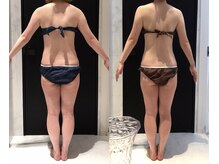 リボディ 表参道(An re Body)/before→after