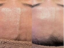 プレジール(plaisir)/おでこフェイシャルワックス