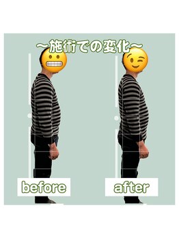 カルラ(KARURA)/頭痛/肩こりがある人は姿勢も×