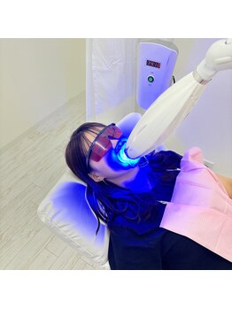 ホワイト 福井店(WHITE)/8.照射