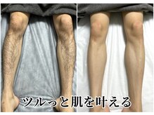 ルシャトン(Le Chaton)の雰囲気（貴方にも叶う、ツルっと綺麗肌）