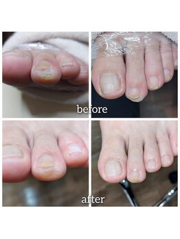 爪切り屋 足楽/