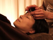 スミレ(紫菫 SUMIRE)の雰囲気（紫外線による肌の奥のダメージへのケアは優しい美容鍼にお任せ♪）