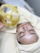 チル(Chill)/【松ヤニパック後】透明感溢れる