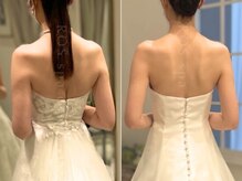 体感/見た目でもわかる結果◎前後で採寸し数字でも効果を実感