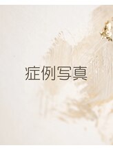 ジフィー(Gify)/筋膜リリースカッター症例写真