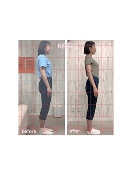 あんず美容整体サロン/◆姿勢症例◆