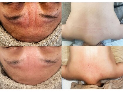 美温(mion)の写真