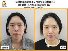 ブプラ 広島店(BUPURA)/before→after