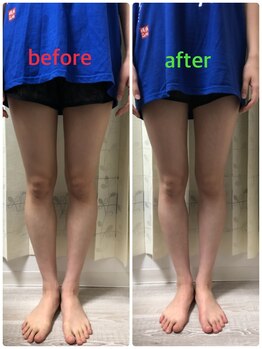 激痛ダイエット整体 八巻/足!/むくみ解消/リンパ