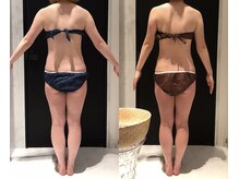 リボディ 表参道(An re Body)/before→after