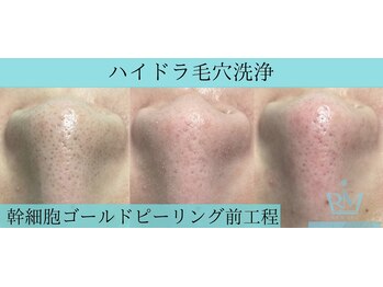 リメイククリニカルビューティー(Remake clinical beauty)/GP前の下準備