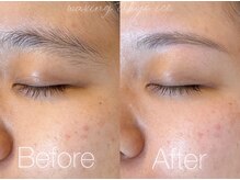 ワクシングトウキョウ アイス 池袋(waxing tokyo ice)/アイブロウワックス