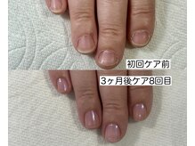 ネイルサロンアンドスクール マルベリー(mulberry)の雰囲気(爪が伸びなくて縦筋が気になっていたけど縦長になり満足です!)