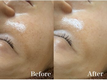 マシェ バイ マユ(Mache by Mayu)/エイジング悩みもハーブで！