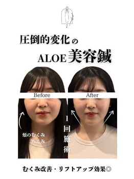 アロエ鍼灸整体院/Before-After