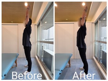 レニコ 三宮店(renico)/BEFORE/AFTER 36