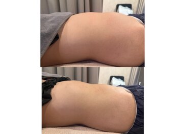 ブリア 横浜(BRILLA)/腸もみ！腸活！ガス抜き！