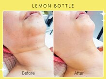 シロカネ 光の森店(SHIROKANE)/レモンボトル☆