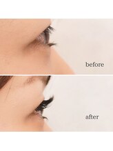 スキン 心斎橋店(skin)/矯正まつげパーマ下＋エクステ上