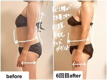 つばききよら/姿勢＆ポッコリお腹が改善！