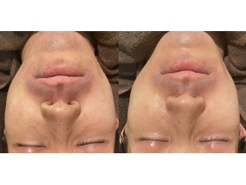 ディサイドロー(DECIDE L.A.W)/男性もお肌を変えたい！