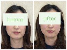 わかくさ鍼灸整体院/