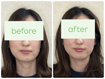 わかくさ鍼灸整体院/