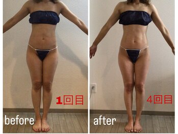 リーノ プロデュースド バイ ティービーピー 香里園店(Liino Produced by TBP)/１ヶ月集中4回コース