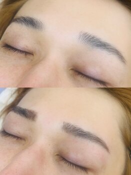 メンズフェイシャル