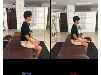 ストレチックス 近江八幡店/腰痛改善ビフォーアフター1回