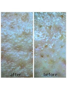 サロン ザ プマロ(SalonThePumalo)/見える効果