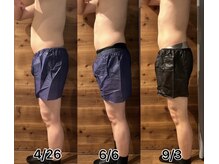 ルミナス/メンズ冷却も◎短期間でこの変化