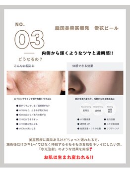 ラ メール(La mer)/★雪花ピールどうなるの?★No3