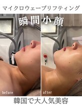 リリー(LILY)/韓国美容　LILY　