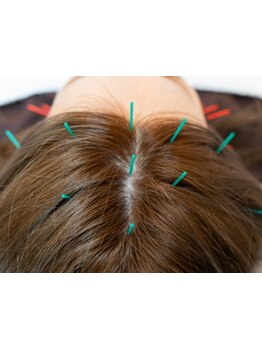 眼精疲労を解消したい