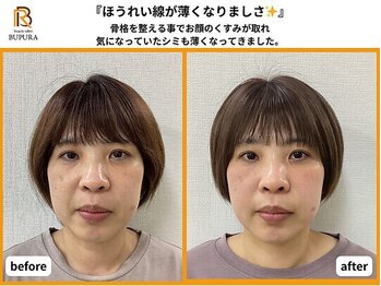ブプラ 広島店(BUPURA)/before→after