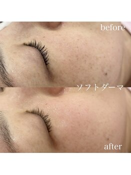リグレイス(Re.Grace)の写真/素肌に、自信を。