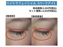 アクティブエイジング/【ハイドラ】パークアイ